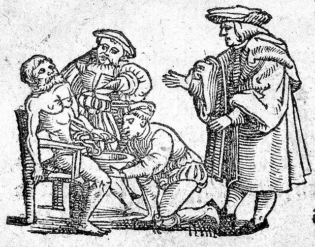 Pouštění žilou (zdroj: Wikimedia Commons) bloodletting