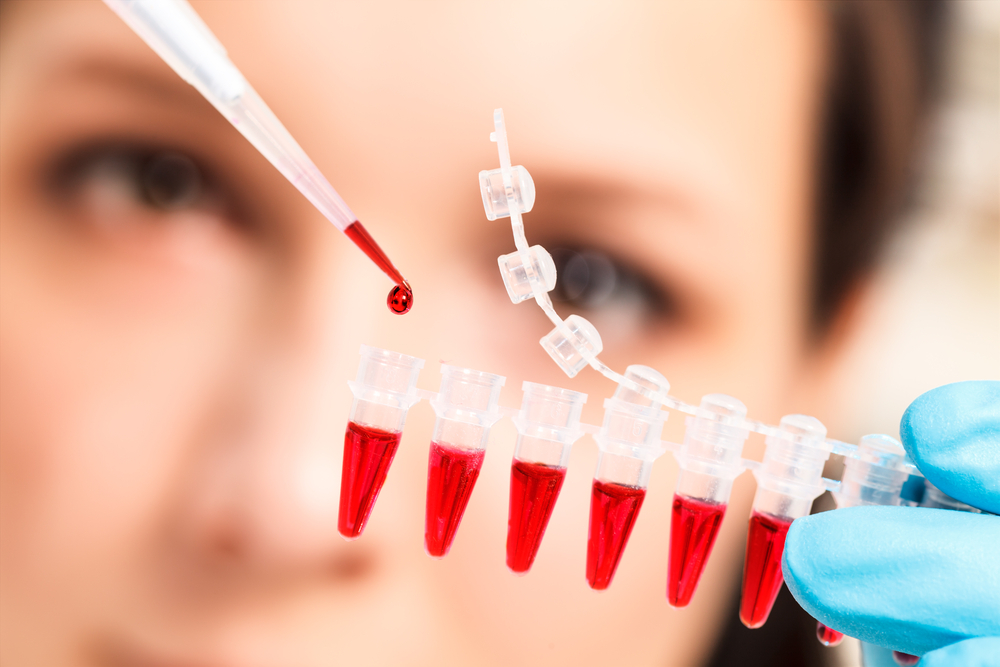 Že by bychom byli zase o krůček blíž k léčbě rakoviny? Nové krevní testy ji odhalí dřív, než se stihne rozšířit. krevni test shutterstock 136518497
