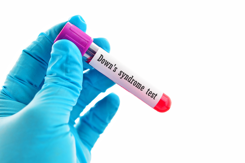 Co všechno budou umět odhalit prenatální testy v budoucnosti? downsyndromtest