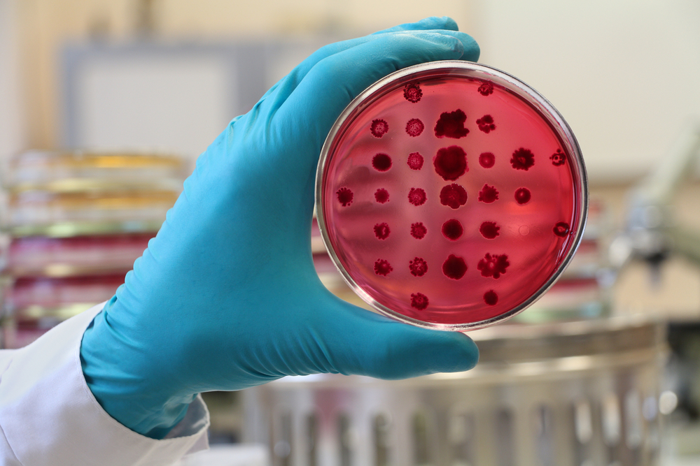 Bakterie E. coli neboli Escherichia coli je jednou z těch, které způsobují infekce nereagující na léčbu. Ačkoliv jsou vzácné, pro zdraví veřejnosti představují rostoucí hrozbu. e.coli shutterstock 582221833