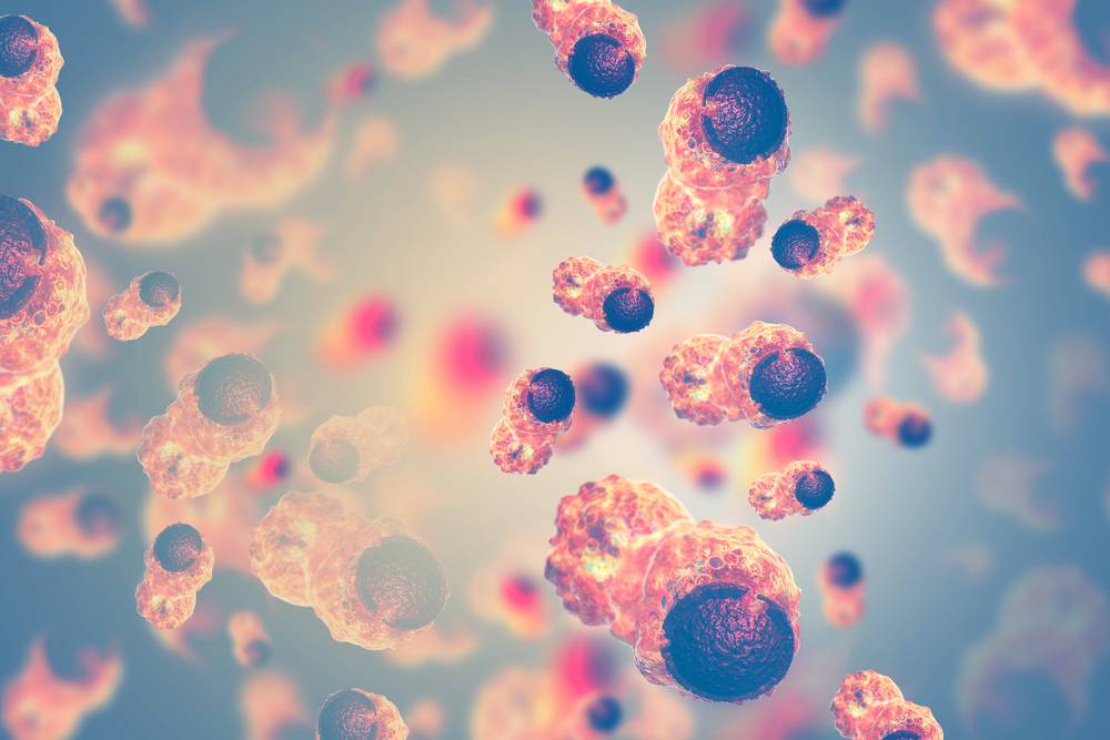 Mezinárodní agentura pro výzkum rakoviny (IARC) klasifikovala akrylamid jen jako pravděpodobný karcinogen. rakovina shutterstock 674497363